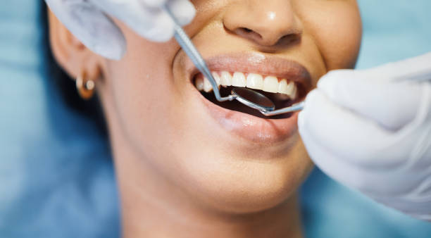 Best Lost Filling or Crown Replacement in Reading, MI